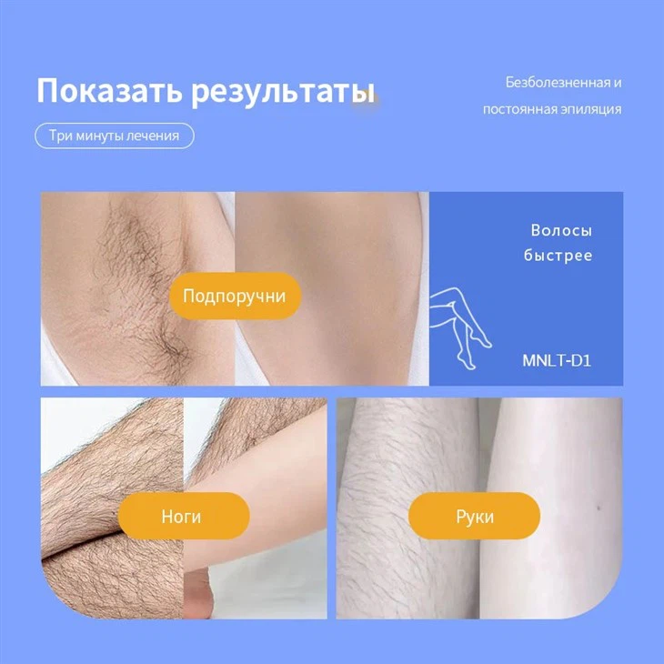 Soprano лед лазерная машина для удаления волос